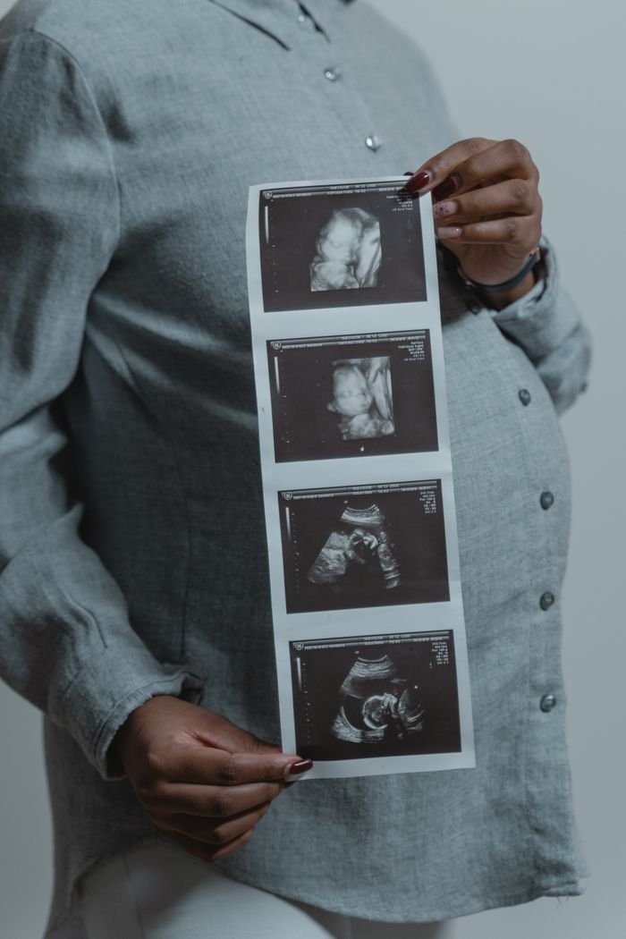 our-services-1 Pregnant woman holding ultrasound scans, symbolizing motherhood and new life.